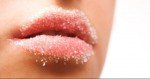 Labbra secche e screpolate: cause e rimedi naturali