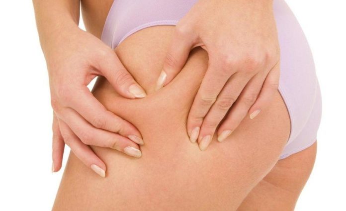 Ritenzione idrica: cause, sintomi, prevenzione, alimentazione e rimedi naturali Ritenzione idrica: cause, sintomi, prevenzione, alimentazione e rimedi naturali