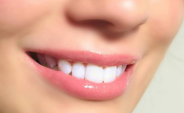 Afta in bocca, sulla lingua o gengivale - cause, sintomi e rimedi naturali