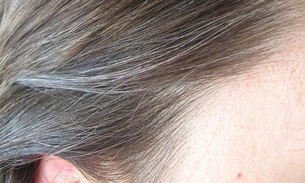 Capelli bianchi: cause, rimedi naturali e trucchi per nascondere la ricrescita