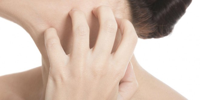 Seborrea: sintomi, cause, rimedi naturali, alimentazione e consigli