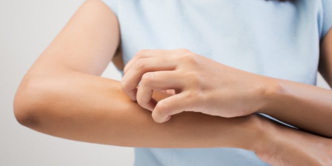 fuoco di sant'antonio è contagioso - herpes zoster sintomi cause cura durata e rimedi contro il fuoco di sant'antonio