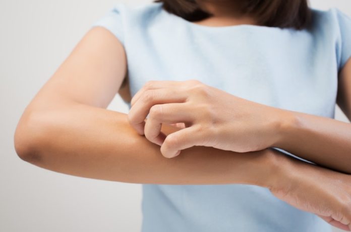 Fuoco di sant'antonio è contagioso - herpes zoster sintomi cause cura durata e rimedi contro il fuoco di sant'antonio fuoco di sant'antonio è contagioso - herpes zoster sintomi cause cura durata e rimedi contro il fuoco di sant'antonio