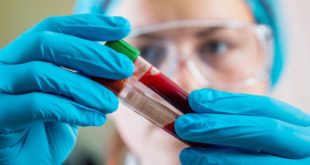 Il controllo al phlebologist è libero in Mosca