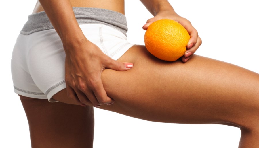 Cellulite: che cos'è, cause, trattamenti medici estetici e trattamenti naturali. Scopri le cause della cellulite e i più efficaci trattamenti medici estetici o trattamenti naturali per combattere la cellulite.