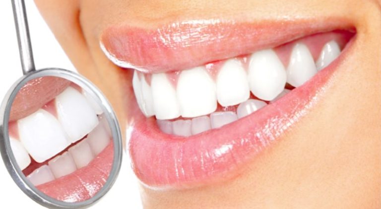 Sbiancamento denti fai da te: metodi naturali efficaci e consigli. Scopri le cause dei denti gialli ed i più efficaci metodi per sbiancare i denti in casa in modo naturale.