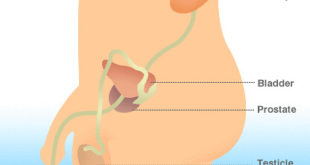 Cos'è e dove si trova la prostata