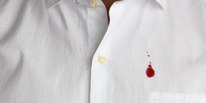 Come Togliere Le Macchie Di Sangue Da Vestiti E Tessuti 6