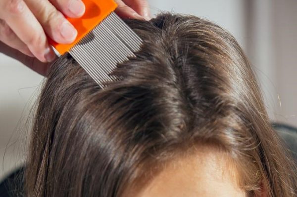 Tutto Sulla Pediculosi Cosa Sono I Pidocchi Sintomi Cura Prevenzione Come Si Trasmettono E Quanto Vivono