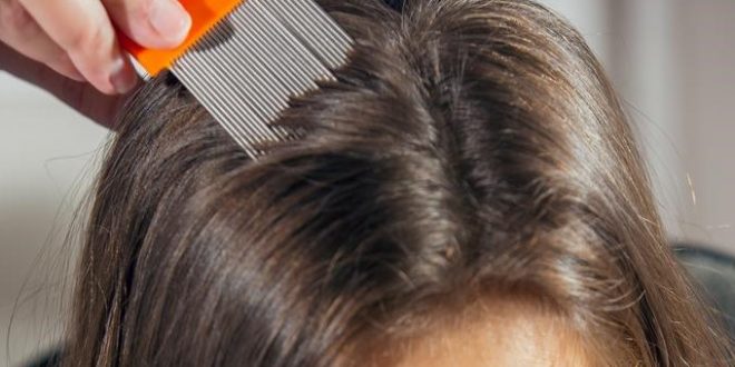 Tutto Sulla Pediculosi Cosa Sono I Pidocchi Sintomi Cura Prevenzione Come Si Trasmettono E Quanto Vivono