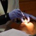 Che cos'è la piorrea o parodontite, come si previene e come si cura
