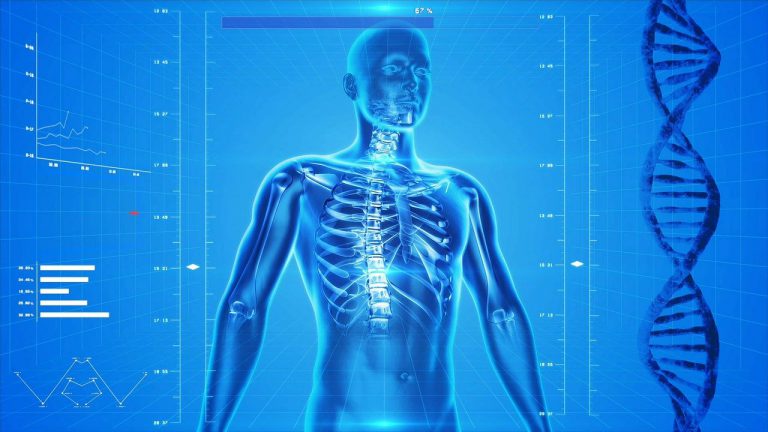 cifosi e altre patologie vertebrali