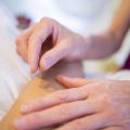 Agopuntura: cos’è, funzioni e benefici, come si esegue e controindicazioni