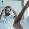Calvizie: a che età si comincia a perdere i capelli