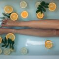 Vene varicose: come curarle in modo naturale