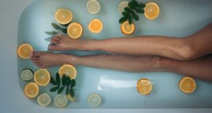 ProdecoPharma_PortaleBenessere_Vene varicose come curarle in modo naturale (1)