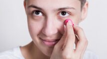 donna-che-applica-crema-per-le-occhiaie