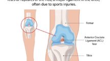 Legamenti ginocchio